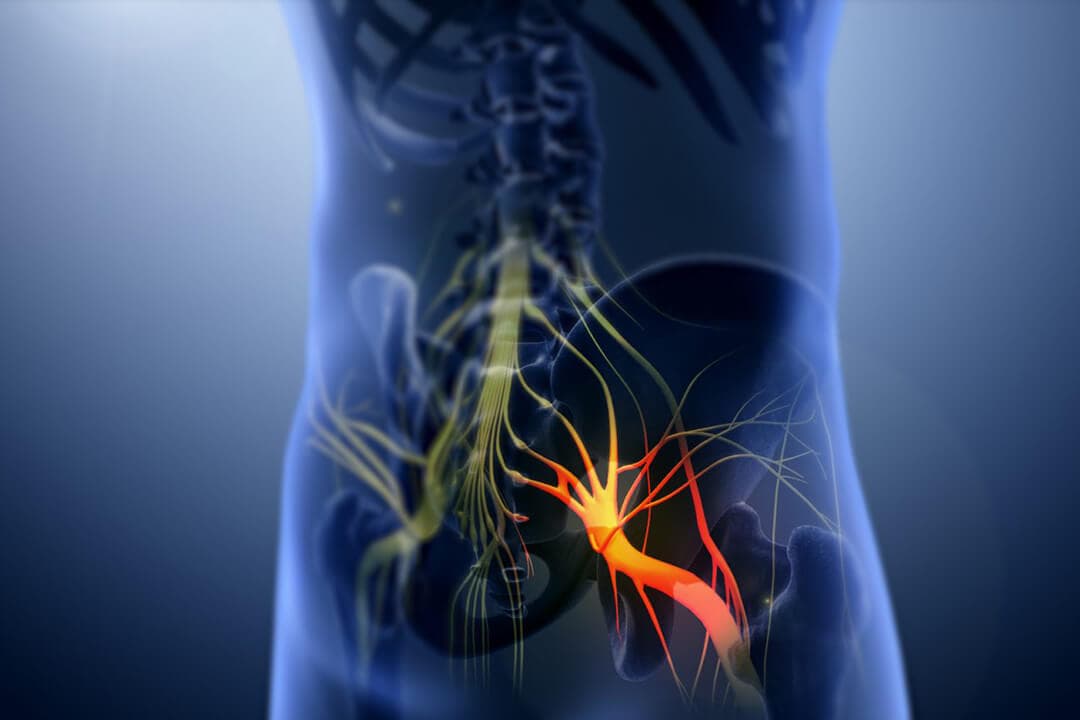 Sciatic-nerve illustration