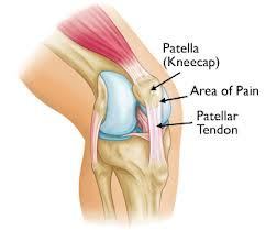 patella-tendon-diagram